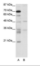 FOXN2 Antibody - A: Marker, B: Jurkat Cell Lysate.  This image was taken for the unconjugated form of this product. Other forms have not been tested.