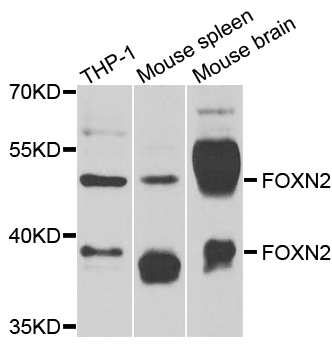 FOXN2 Antibody - Western blot analysis of extracts of various cells.