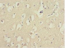 FOXN2 Antibody - Immunohistochemistry of paraffin-embedded human brain at dilution 1:100