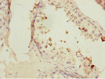 FOXN2 Antibody - Immunohistochemistry of paraffin-embedded human testis tissue at dilution 1:100