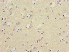 FOXN2 Antibody - Immunohistochemistry of paraffin-embedded human brain at dilution 1:100