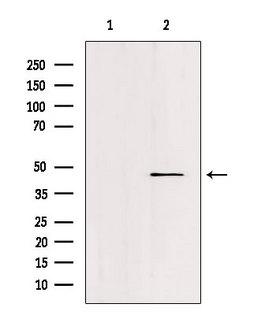 FOXN2 Antibody - Western blot analysis of extracts of c476 using FOXN2 antibody. Lane 1 was treated with the blocking peptide.