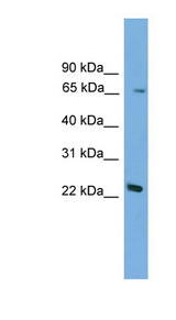 FOXN2 Antibody - FOXN2 antibody Western blot of Mouse liver lysate. This image was taken for the unconjugated form of this product. Other forms have not been tested.
