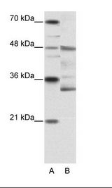 FOXN2 Antibody - A: Marker, B: HepG2 Cell Lysate.  This image was taken for the unconjugated form of this product. Other forms have not been tested.