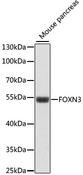 FOXN3 / CHES1 Antibody - Western blot analysis of extracts of mouse pancreas using FOXN3 Polyclonal Antibody at dilution of 1:1000.