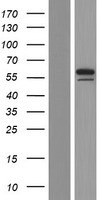 FOXN3 / CHES1 Protein - Western validation with an anti-DDK antibody * L: Control HEK293 lysate R: Over-expression lysate