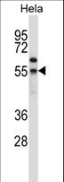 FOXN4 Antibody - FOXN4 Antibody western blot of HeLa cell line lysates (35 ug/lane). The FOXN4 antibody detected the FOXN4 protein (arrow).