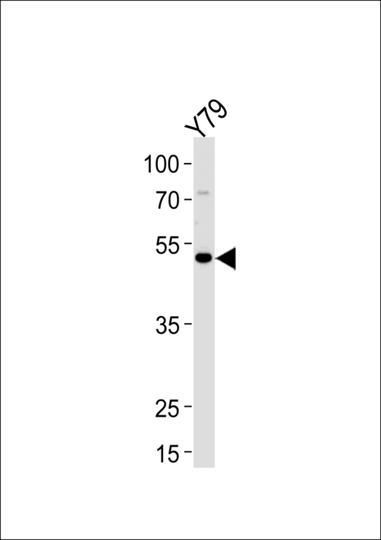 FOXN4 Antibody - Western blot of lysate from Y79 cell line, using FOXN4 Antibody. Antibody was diluted at 1:1000 at each lane. A goat anti-rabbit IgG H&L (HRP) at 1:5000 dilution was used as the secondary antibody. Lysate at 35ug.