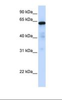 FOXN4 Antibody - Hela cell lysate. Antibody concentration: 1.0 ug/ml. Gel concentration: 12%.  This image was taken for the unconjugated form of this product. Other forms have not been tested.