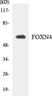 FOXN4 Antibody - Western blot analysis of the lysates from HeLa cells using FOXN4 antibody.