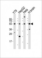 FOXN4 Antibody - All lanes : Anti-FOXN4 Antibody at 1:2000 dilution Lane 1: Y79 whole cell lysates Lane 2: HepG2 whole cell lysates Lane 3: HeLa whole cell lysates Lane 4: human brain lysates Lysates/proteins at 20 ug per lane. Secondary Goat Anti-Rabbit IgG, (H+L), Peroxidase conjugated at 1/10000 dilution Predicted band size : 55 kDa Blocking/Dilution buffer: 5% NFDM/TBST.