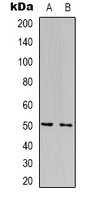 FOXN4 Antibody - Western blot analysis of FOXN4 expression in Jurkat (A); HepG2 (B) whole cell lysates.