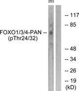 FOXO1+3+4 Antibody - Western blot analysis of extracts from 293 cells, treated with Serum (20%, 15mins), using FOXO1/3/4-pan (Phospho-Thr24/32) antibody.