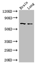 FOXO1 / FKHR Antibody - Positive WB detected in:Mouse brain tissue,Mouse lung tissue;All lanes: FOXO1 antibody at 2.5ug/ml;Secondary;Goat polyclonal to rabbit IgG at 1/50000 dilution;Predicted band size: 70 kDa;Observed band size: 70 kDa;