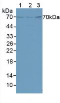 FOXO1 / FKHR Antibody - Western Blot; Sample: Lane1: Mouse Liver Tissue; Lane2: Rat Liver Tissue; Lane3: Human Hela Cells.