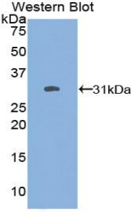 FOXO1 / FKHR Antibody - Western blot of recombinant FOXO1 / FKHR.  This image was taken for the unconjugated form of this product. Other forms have not been tested.