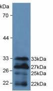 FOXO1 / FKHR Antibody - Western Blot; Sample: Recombinant FOXO1, Mouse.