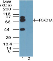 FOXO1 / FKHR Antibody - Western blot of FOXO1A in human ovary lysate in the 1) absence and 2) presence of immunizing peptide using Peptide-affinity Purified Polyclonal Antibody to FOXO1A at 0.05 ug/ml.