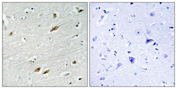 FOXO1 / FKHR Antibody - Immunohistochemistry analysis of paraffin-embedded human brain tissue, using FKHR Antibody. The picture on the right is blocked with the synthesized peptide.