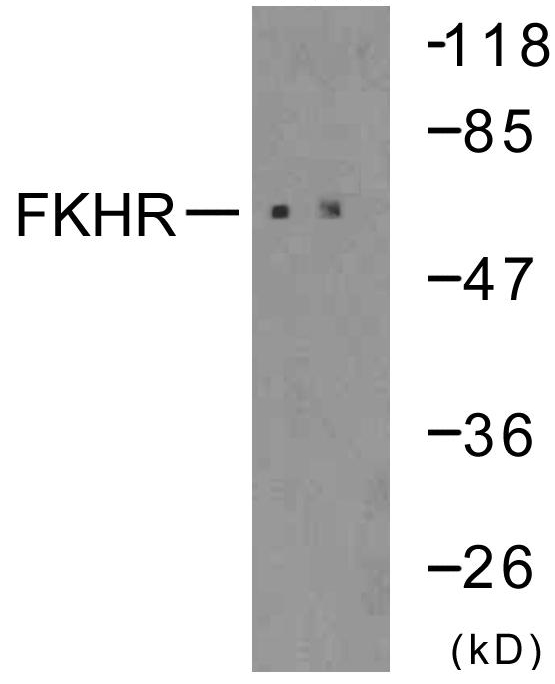 FOXO1 / FKHR Antibody - Western blot analysis of lysates from 293 cells, treated with serum 10% 15', using FKHR Antibody. The lane on the right is blocked with the synthesized peptide.