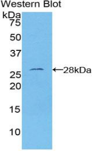FOXO1 / FKHR Antibody - Western blot of recombinant FOXO1 / FKHR.  This image was taken for the unconjugated form of this product. Other forms have not been tested.