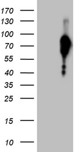FOXO1 / FKHR Antibody - HEK293T cells were transfected with the pCMV6-ENTRY control. (Left lane) or pCMV6-ENTRY FOXO1. (Right lane) cDNA for 48 hrs and lysed