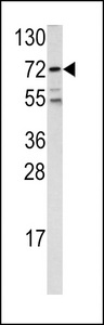 FOXO1 / FKHR Antibody - Western blot of FKHR antibody (Center D469) in 293 cell line lysates (35 ug/lane). FKHR (arrow) was detected using the purified antibody.