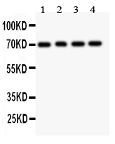 FOXO1 / FKHR Antibody - FOXO1A antibody Western blot. All lanes: Anti FOXO1A at 0.5 ug/ml. Lane 1: Rat Lung Tissue Lysate at 50 ug. Lane 2: Rat Brain Tissue Lysate at 50 ug. Lane 3: COLO320 Whole Cell Lysate at 40 ug . Lane 4: HEPG2 Whole Cell Lysate at 40 ug. Predicted band size: 70 kD. Observed band size: 70 kD.