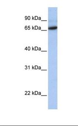 FOXO1 / FKHR Antibody - Transfected 293T cell lysate. Antibody concentration: 1.0 ug/ml. Gel concentration: 12%.  This image was taken for the unconjugated form of this product. Other forms have not been tested.