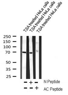 FOXO1 / FKHR Antibody - Western blot analysis on TSA treated HeLa cell lysates using AC-FKHR(K294) antibody