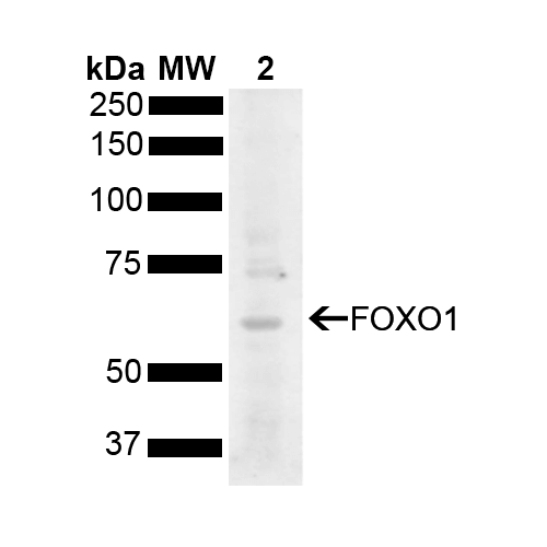 FOXO1 / FKHR Antibody - Western blot analysis of Rat Liver showing detection of 69.7 kDa FOXO1 protein using Rabbit Anti-FOXO1 Polyclonal Antibody. Lane 1: Molecular Weight Ladder (MW). Lane 2: Rat Liver. Load: 15 µg. Block: 5% Skim Milk powder in TBST. Primary Antibody: Rabbit Anti-FOXO1 Polyclonal Antibody  at 1:1000 for 2 hours at RT with shaking. Secondary Antibody: Goat Anti-Rabbit IgG: HRP at 1:5000 for 1 hour at RT. Color Development: ECL solution for 5 min at RT. Predicted/Observed Size: 69.7 kDa. Other Band(s): 75 kDa.