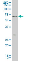FOXO1 / FKHR Antibody - FOXO1A monoclonal antibody (M12), clone 3A10 Western blot of FOXO1A expression in SW-13.