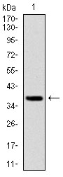 FOXO1 / FKHR Antibody - Western blot using FOXO1 monoclonal antibody against human FOXO1 (AA: 471-600) recombinant protein. (Expected MW is 39.3 kDa)
