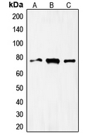 FOXO1 / FKHR Antibody - Western blot analysis of FOXO1 expression in HeLa (A); MCF7 (B); Jurkat (C) whole cell lysates.