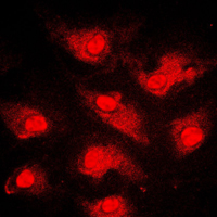 FOXO1 / FKHR Antibody - Immunofluorescent analysis of FOXO1 staining in MCF7 cells. Formalin-fixed cells were permeabilized with 0.1% Triton X-100 in TBS for 5-10 minutes and blocked with 3% BSA-PBS for 30 minutes at room temperature. Cells were probed with the primary antibody in 3% BSA-PBS and incubated overnight at 4 C in a humidified chamber. Cells were washed with PBST and incubated with a DyLight 594-conjugated secondary antibody (red) in PBS at room temperature in the dark. DAPI was used to stain the cell nuclei (blue).