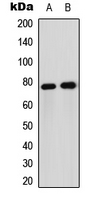 FOXO1 / FKHR Antibody - Western blot analysis of FOXO1 expression in Jurkat (A); HeLa (B) whole cell lysates.