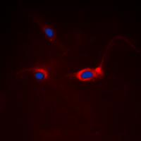FOXO1 / FKHR Antibody - Immunofluorescent analysis of FOXO1 staining in HeLa cells. Formalin-fixed cells were permeabilized with 0.1% Triton X-100 in TBS for 5-10 minutes and blocked with 3% BSA-PBS for 30 minutes at room temperature. Cells were probed with the primary antibody in 3% BSA-PBS and incubated overnight at 4 deg C in a humidified chamber. Cells were washed with PBST and incubated with a DyLight 594-conjugated secondary antibody (red) in PBS at room temperature in the dark. DAPI was used to stain the cell nuclei (blue).
