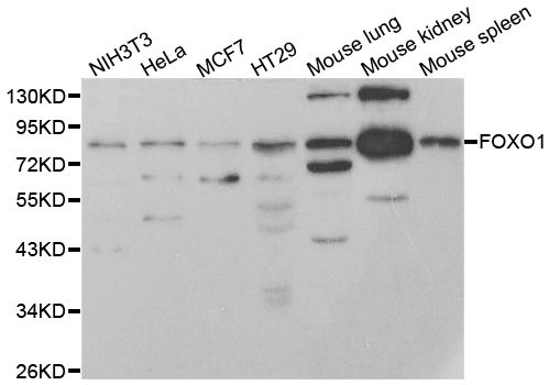 FOXO1 / FKHR Antibody - Western blot analysis of extracts of various cell lines.