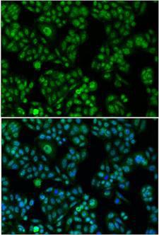FOXO1 / FKHR Antibody - Immunofluorescence analysis of A549 cells.