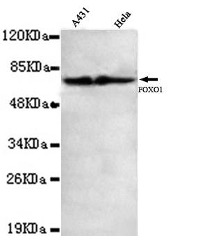 FOXO1 / FKHR Antibody - Western blot detection of FOXO1(C-terminus) in A431 and HeLa cell lysates using FOXO1(C-terminus) mouse monoclonal antibody (1:1000 dilution). Predicted band size: 70KDa. Observed band size: 70KDa.