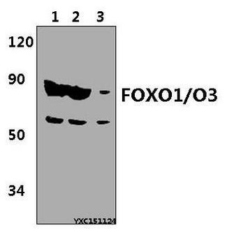 FOXO1 / FKHR Antibody - Western blot of FOXO1/O3 polyclonal antibody at 1:500 dilution. Lane 1: A549 whole cell lysate (40 ug). Lane 2: HeLa whole cell lysate.
