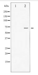 FOXO1 / FKHR Antibody - Western blot of FOXO1A expression in Serum treated HeLa whole cell lysates,The lane on the left is treated with the antigen-specific peptide