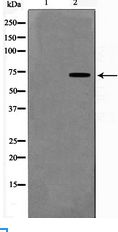 FOXO1 / FKHR Antibody - Western blot of FKHR expression in HeLa whole cell lysates,The lane on the left is treated with the antigen-specific peptide.