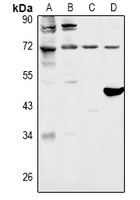 FOXO1 / FKHR Antibody - Western blot analysis of FOXO1 expression in HEK293T (A), Hela (B), rat brain (C), mouse brain (D) whole cell lysates.