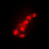 FOXO1 / FKHR Antibody - Immunofluorescent analysis of FOXO1 staining in A549 cells. Formalin-fixed cells were permeabilized with 0.1% Triton X-100 in TBS for 5-10 minutes and blocked with 3% BSA-PBS for 30 minutes at room temperature. Cells were probed with the primary antibody in 3% BSA-PBS and incubated overnight at 4 °C in a hidified chamber. Cells were washed with PBST and incubated with Alexa Fluor 647-conjugated secondary antibody (red) in PBS at room temperature in the dark.
