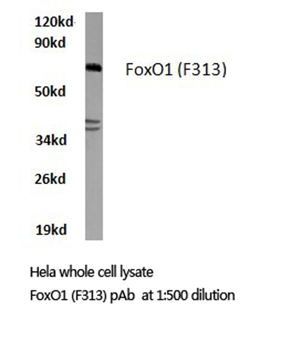 FOXO1 / FKHR Antibody - Western blot of FoxO1 (F313) pAb in extracts from HeLa cells.
