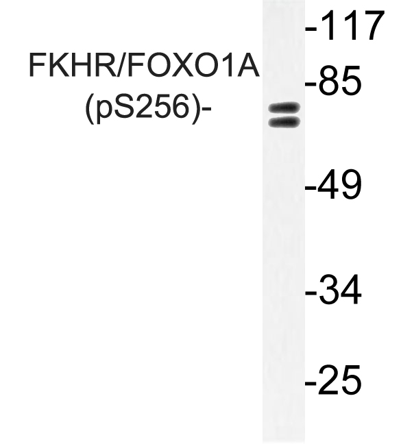 FOXO1 / FKHR Antibody - Western blot of p-FKHR/FOXO1A (S256) pAb in extracts from NIH/3T3 cells.