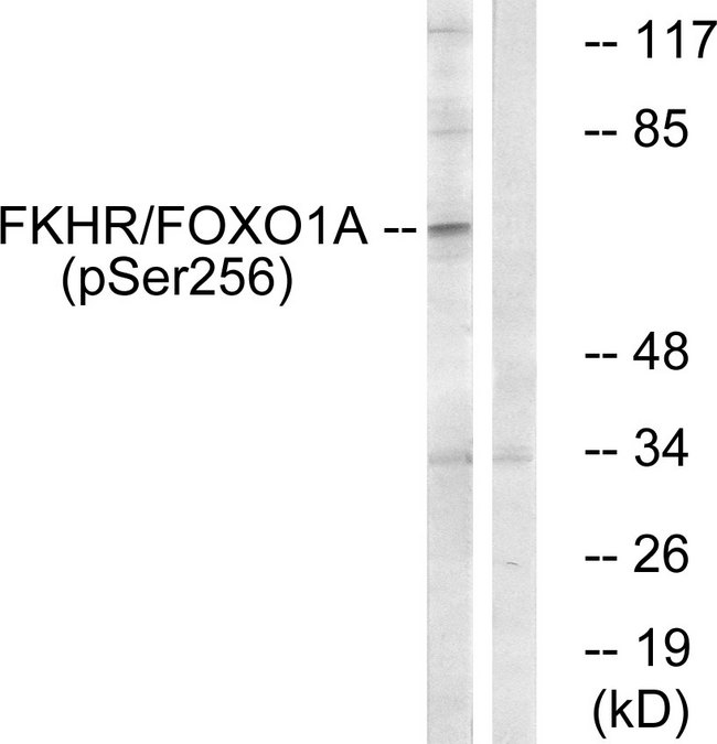 FOXO1 / FKHR Antibody - Western blot analysis of lysates from HeLa cells treated with EGF+Serum, using FKHR (Phospho-Ser256) Antibody. The lane on the right is blocked with the phospho peptide.