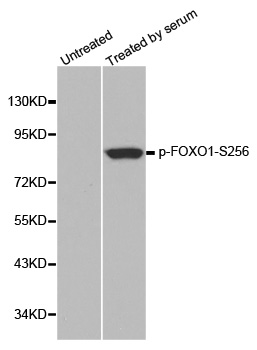 FOXO1 / FKHR Antibody - Western blot analysis of extracts from 293 cells.