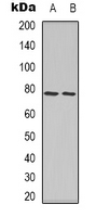 FOXO1 / FKHR Antibody - Western blot analysis of FOXO1 (pS256) expression in HeLa (A); SHSY5Y (B) whole cell lysates.